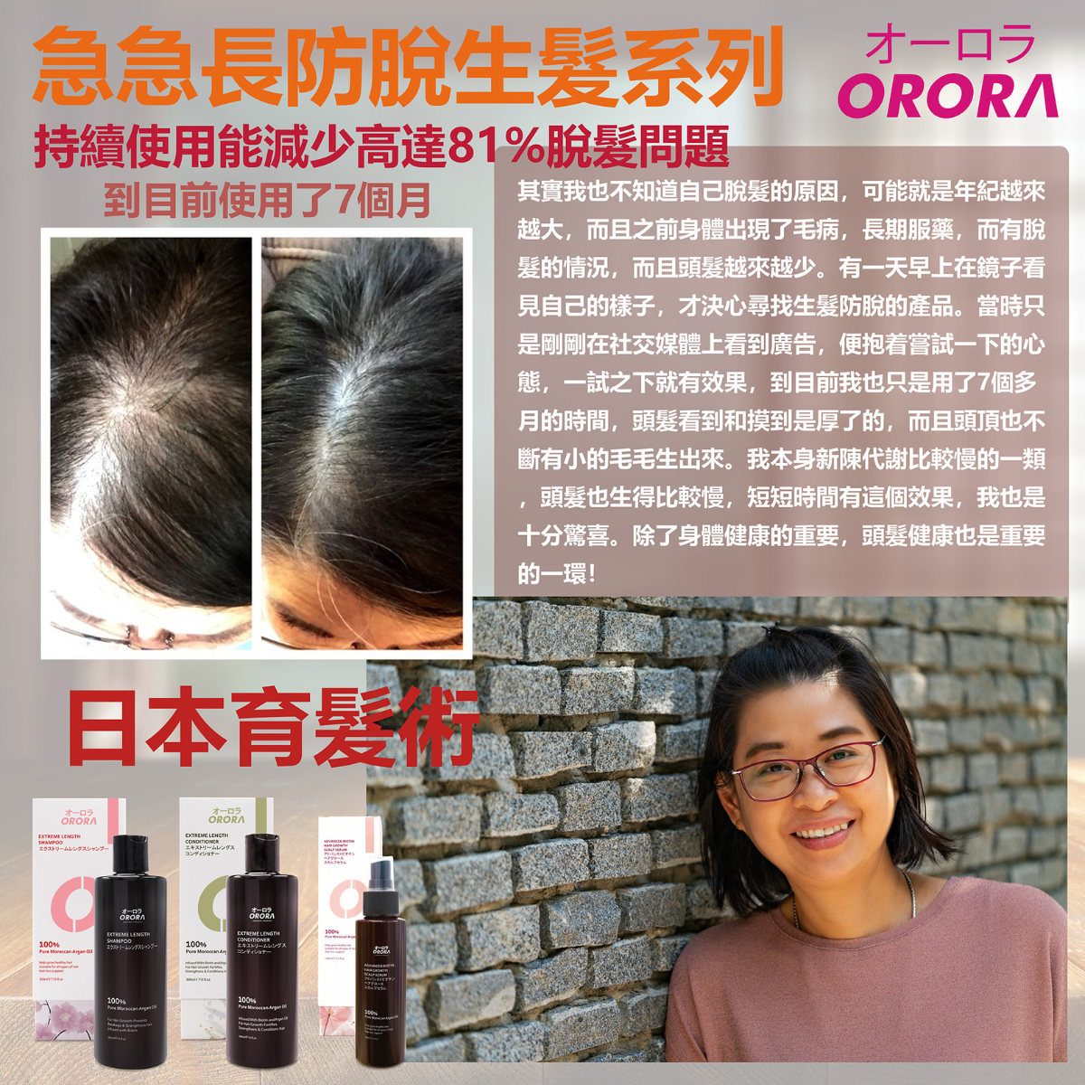 ORORA - 日本頭髮急急長洗髮水 300毫升