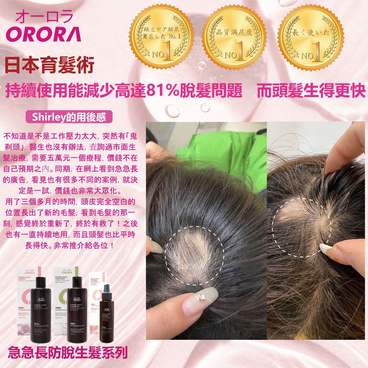 ORORA - 日本頭髮急急長洗髮水 300毫升